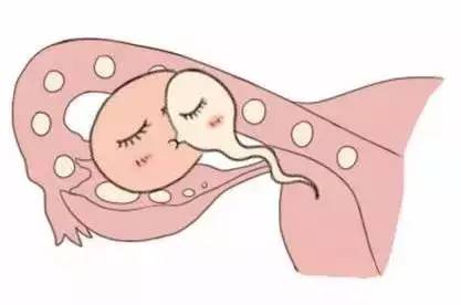 私人孕妈供卵代怀服务选性别